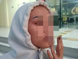 Luka di Dahi hingga Jari Terlepas, Warga Penarukan Jadi Korban Dugaan Penganiayaan